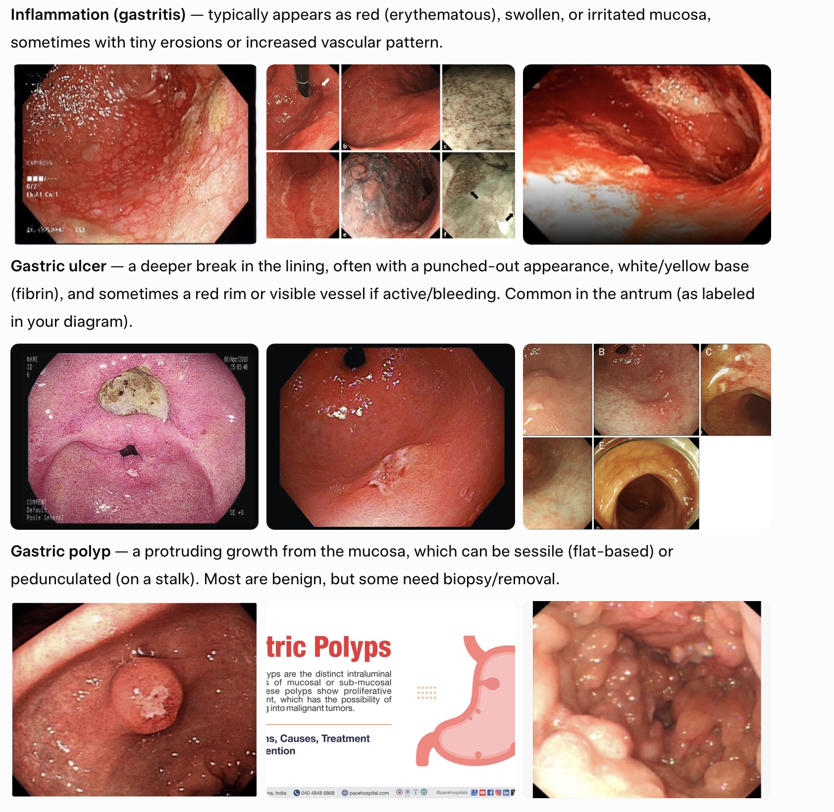 Gastroscopy